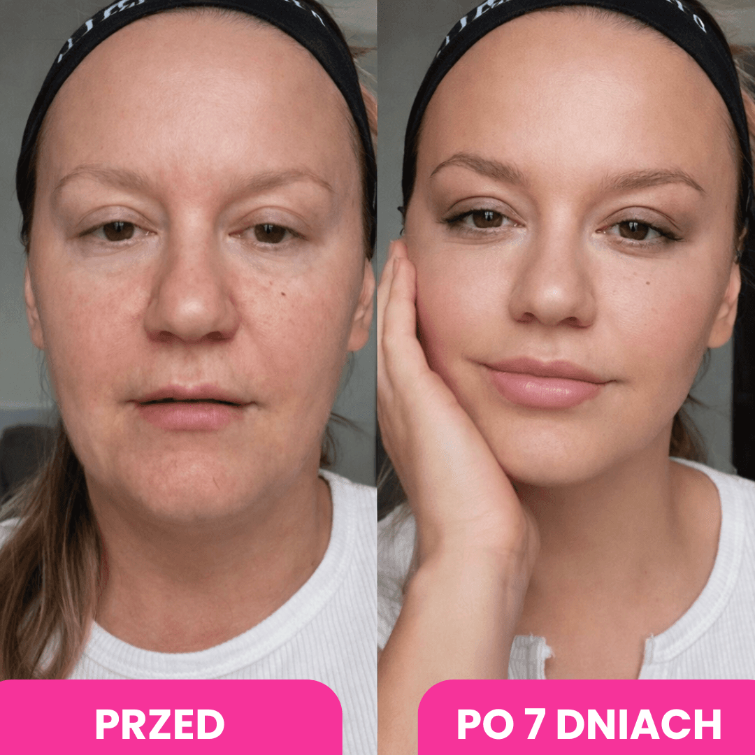 Widoczna różnica w wyglądzie twarzy po kilku dniach