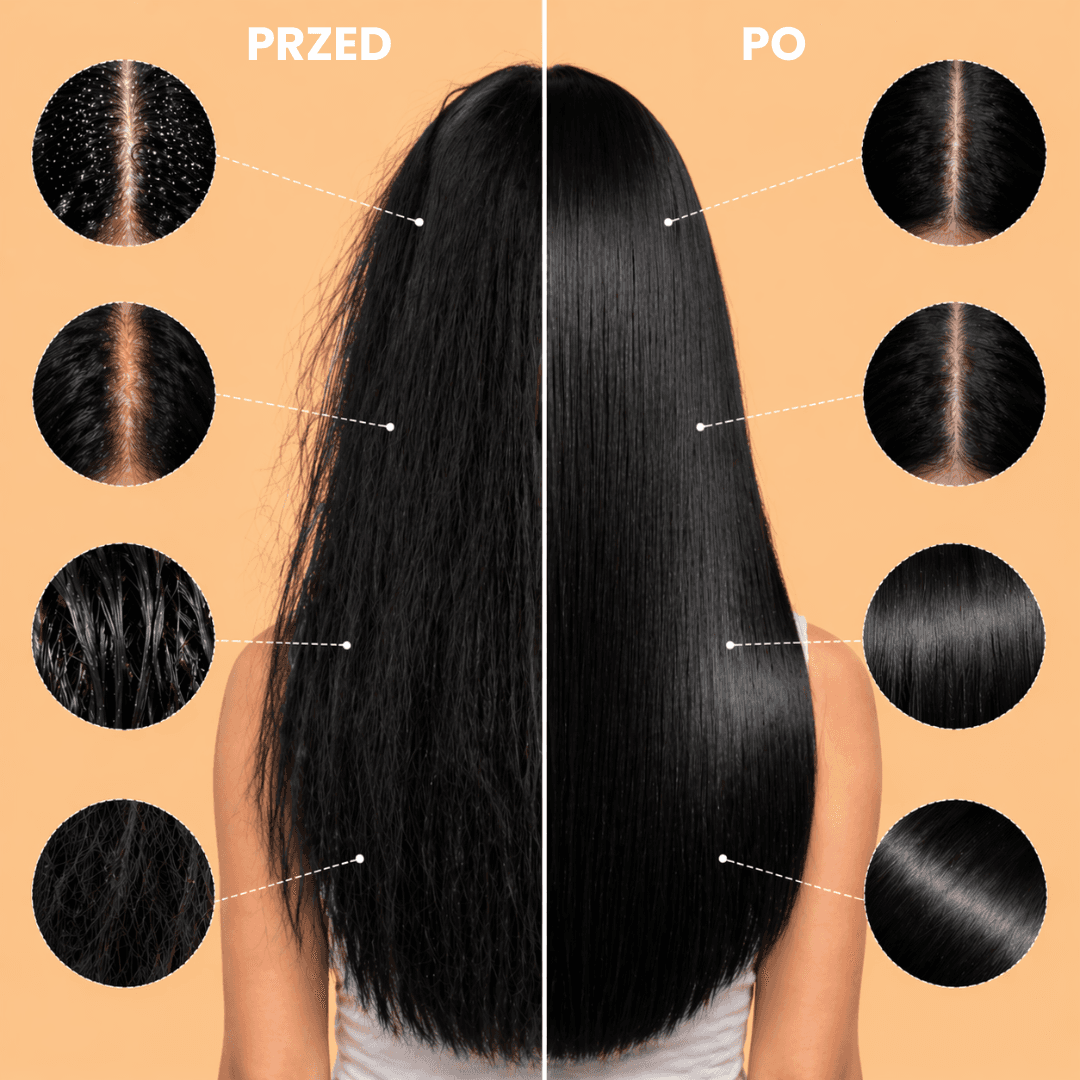 Greting-grzebień do usuwania łupieżu