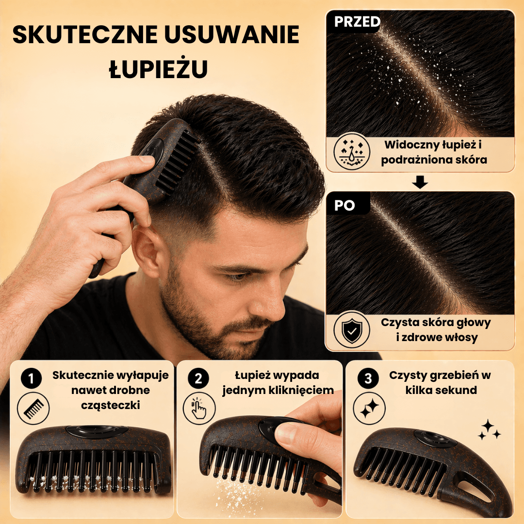 Greting-grzebień do usuwania łupieżu