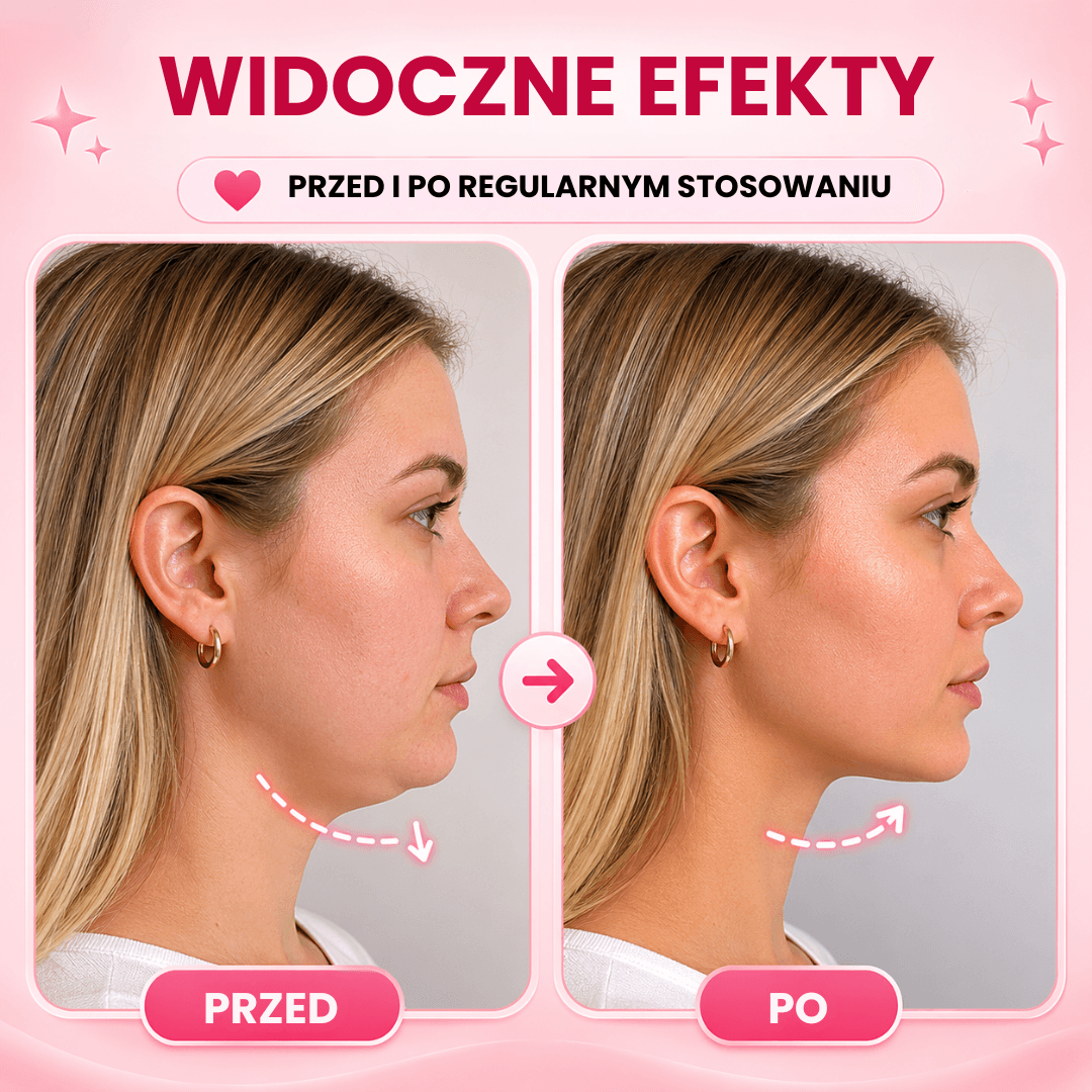 Nafli - maska do liftingu twarzy w kształcie litery V