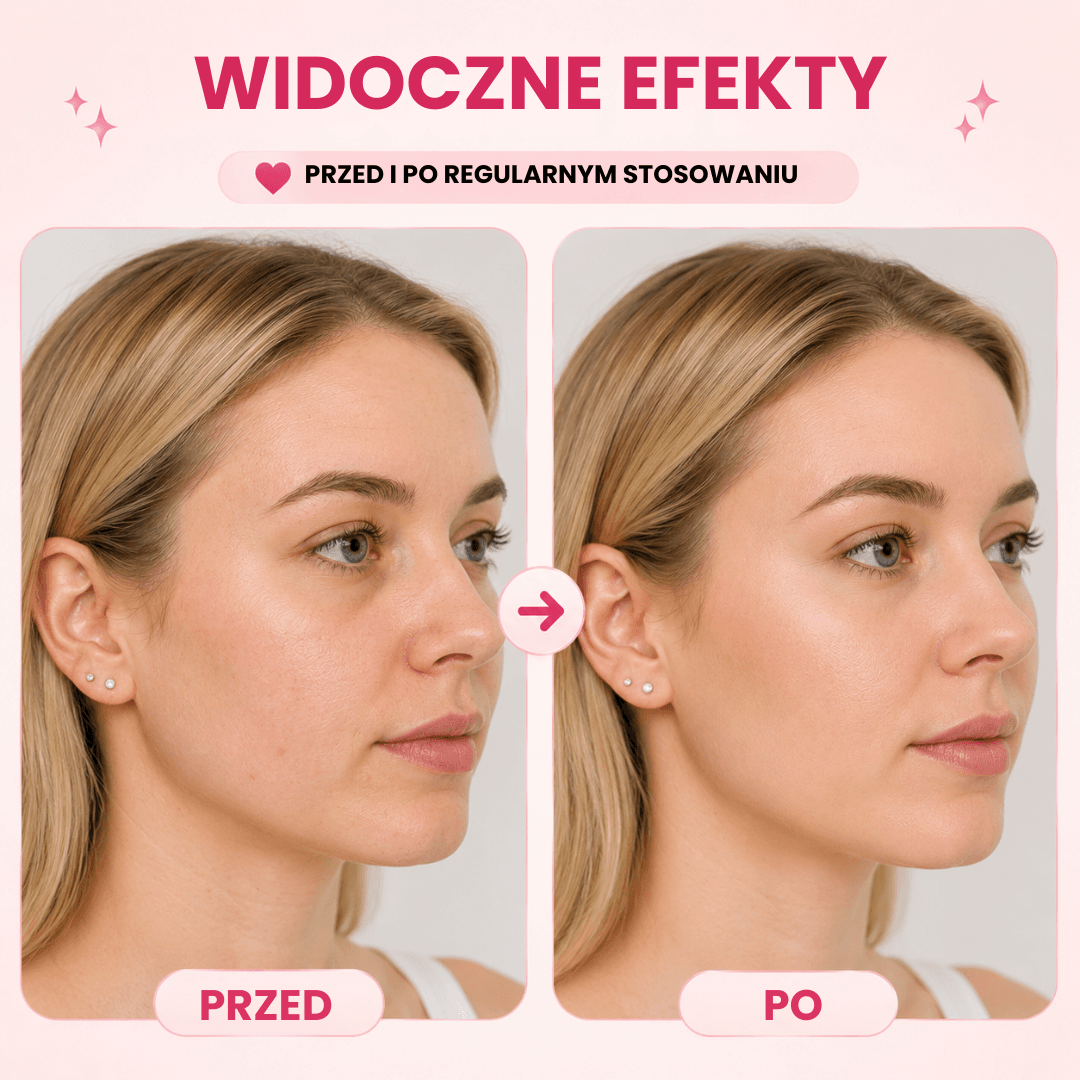 Nafli - maska do liftingu twarzy w kształcie litery V