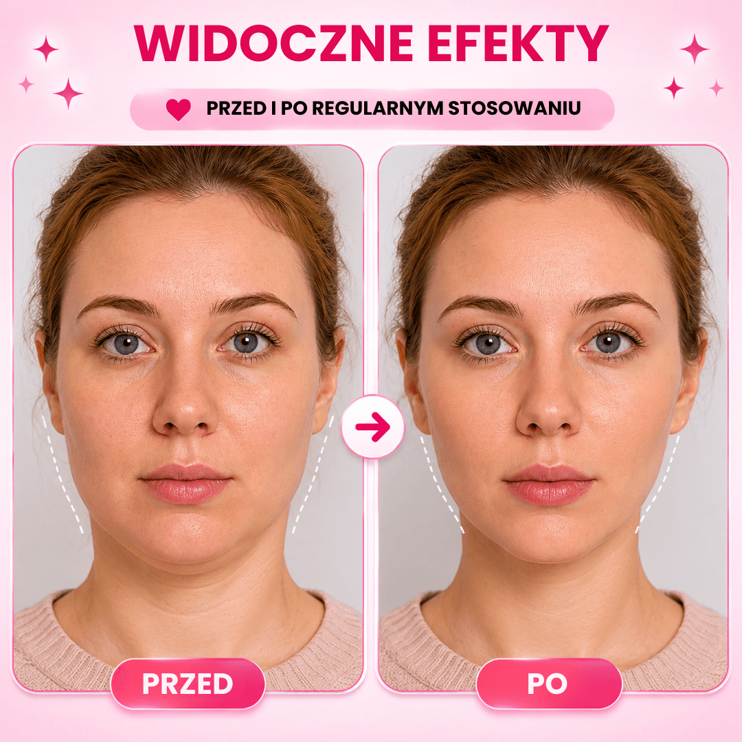 Nafli - maska do liftingu twarzy w kształcie litery V