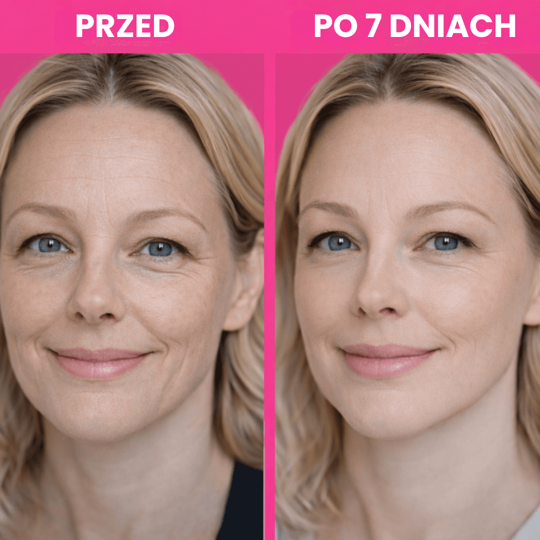 Slitep - taśma do liftingu twarzy i ciała